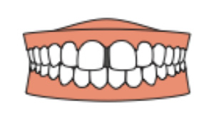 すきっ歯のイラスト