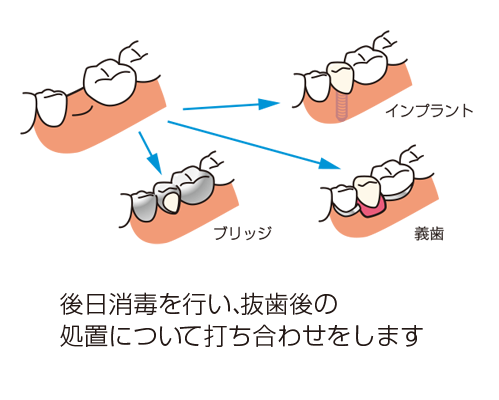 その後の処置を選択するイラスト